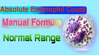 Absolute Eosinophil Count FormulaHow to count absolute eosinophilhow to count aecAEC [upl. by Vish]