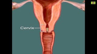 How to Calculate Safe Days Fertile daysovulation days a 30 day cyclesafe days to avoid pregnancy [upl. by Charline]