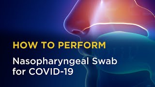 Nasopharyngeal Swab for COVID19 [upl. by Airakaz]