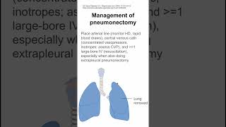 Management of pneumonectomy [upl. by Nuhsed]