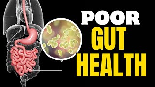 How to Improve Gut Health 5 foods to INSTANTLY improve GUT HEALTH [upl. by Zonda]