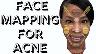 Face Mapping For Acne [upl. by Kealey]