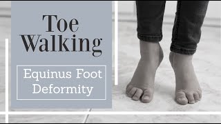 Toe walking in kids and adults  Equinus foot deformity [upl. by Heidi]