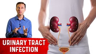 Top Remedies for a UTI Urinary Tract Infection Updated [upl. by Danette374]