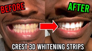 Using Crest 3D Whitestrips in 2022 Honest Review  How to Whiten Yellow Teeth [upl. by Laehcym]