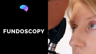 Fundoscopy Ophthalmoscopy  OSCE Guide  UKMLA  CPSA [upl. by Lothario960]