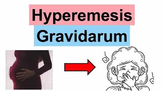 Gynecology Hyperemesis gravidarum HG Dr Doaa Qasim 20242025 [upl. by Rickie311]