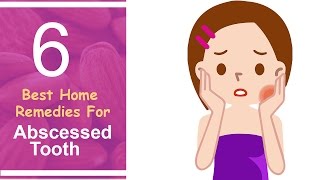 6 Best Home Remedies For Abscessed Tooth [upl. by Necyrb100]