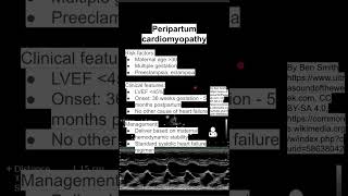 Peripartum cardiomyopathy [upl. by Myke136]