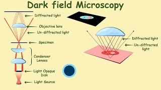 Dark field microscopy  Dark field microscope  dark field microscopy in hindi  Urdu  Microbiology [upl. by Aianat]