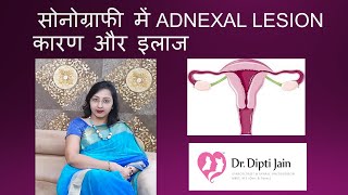 सोनोग्राफी में ADNEXAL LESION कारण और इलाज [upl. by Elata684]