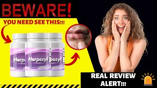 HERPESYL  BUYER BEWARE  Herpesyl Review  Herpesyl Pills – Does Herpesyl Work [upl. by Marx]