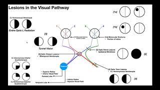 Visual Fields to Confrontation [upl. by Arbma867]