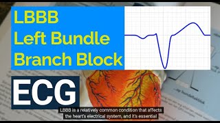 Understanding Left Bundle Branch Block LBBB on ECG Causes Symptoms and Treatment [upl. by Audly]