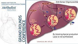 Lipoproteina in Coronary Disease An Emerging Novel Target Steven E Nissen MD February 14 2019 [upl. by Asamot428]