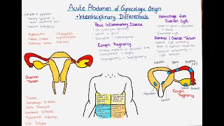 Acute Abdomen of Gynecological and NonGynecological Origin [upl. by Clotilde]