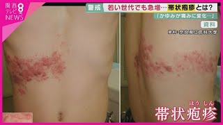 「かゆみが痛みに…」若い世代でも患者急増の「帯状疱疹」気づきにくく治療が遅れ重症化するケースも “免疫機能”を高めることが予防のポイント【報道ランナー】 [upl. by Aihsit690]