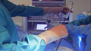 Laparoscopic Hysterectomy [upl. by Nnylakcaj347]