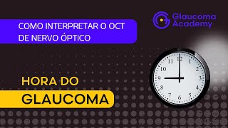 Como interpretar o OCT de nervo óptico [upl. by Zoi]