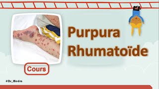 Enfant avec tâches purpuriques cutanées👶  📚 Purpura Rhumatoïde  Cours  Pédiatrie [upl. by Dre]