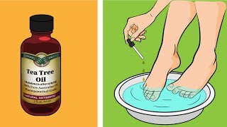 Tea tree oil is far more useful than you think  7 reasons to have tea tree oil in your house [upl. by Nilats354]