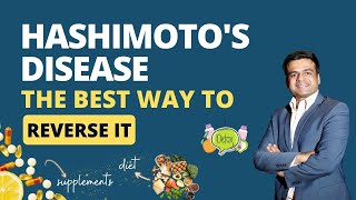 What is Hashimotos Disease Symptoms of Hashimotos  The Best way to Reverse Hashimotos Disease [upl. by Norrehs]