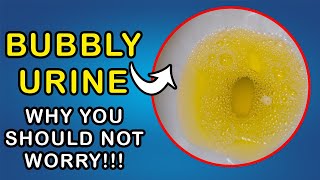 BUBBLES IN URINE Why you dont need to worry [upl. by Ceciley]