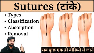 Sutures  Types Classification Removal and Absorption in Hindi  Nursing  Surgery  Medical  GNM [upl. by Seamus639]