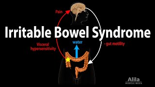 Irritable Bowel Syndrome Pathophysiology Symptoms Causes Diagnosis and Treatment Animation [upl. by Xenophon]