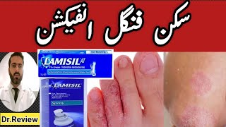 skin fungal infections treatment  Lamisil spray  lamisil cream uses Best Fungal Infection cream [upl. by Eux441]