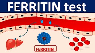 Serum Ferritin test  Its role in inflammation [upl. by Aronson845]