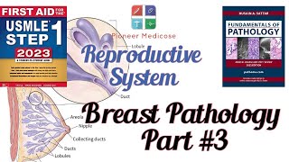 Uterine neoplasm and Breast pathology from Pathoma Part3 Reproductive system pathUrduHindi [upl. by Hgielyk]