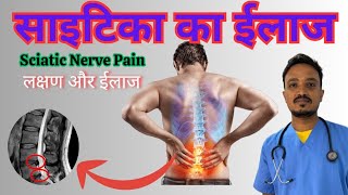 साइटिका का ईलाज। Sciatic Nerve Pain [upl. by Cleon]