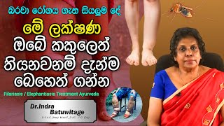 Filariasis Sinhala Lymphatic filariasis  කකුලක් ඉදිමීම ඇග කැසීම බරවා රෝගයේ ලක්ෂණයක් විය හැකියි [upl. by Geri]