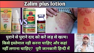 Zalim plus lotion use dose benefits and Side effects full review in hindi [upl. by Attenyw]