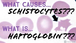 What causes Schistocytes What is Haptoglobin Hematology Hematopathology Basics [upl. by Deer]