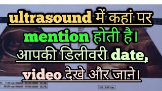 अल्ट्रासाउंड रिपोर्ट में डिलीवरी date कहा पर होती है।। LMP।EDD।। Ultrasound report ।। [upl. by Wolff]