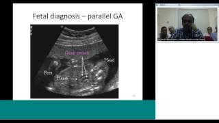 dTGA diagnosis and preoperative assessment by Dr Sivakumar [upl. by Girardi]