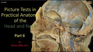 Picture tests in head and neck anatomy 6 [upl. by Nima]