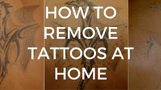 How To Remove Tattoos at Home Using a TCA Peel [upl. by Wilonah27]