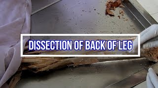 Dissection of Back of Leg [upl. by Haslam14]