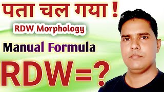 RDW blood test hindi  RDW manual formul  RDW morphology [upl. by Nicolle]