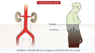 Doença renal  Causas e tratamento [upl. by Viridis446]