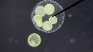 Midday DancerVolvox aureus under the microscope [upl. by Annoeik]