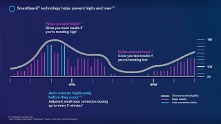Tips for Using SmartGuard™ Technology with the MiniMed™ 780G System [upl. by Nims]