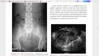 ATLAS OF EMERGENCY RADIOLOGY [upl. by Adriano]