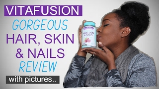 VITAFUSION HAIR SKIN AND NAILS GUMMIES REVIEW｜SHELETHIA TRENAE [upl. by Aramo]