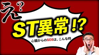 【心電図】健康診断でST異常は心筋梗塞の可能性？循環器内科医が詳しく解説 [upl. by Ysdnyl]