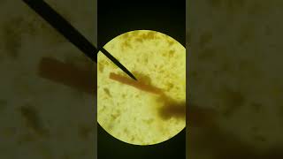 Microbiology Strongyloides stercoralis [upl. by Nnod]