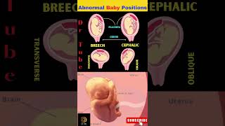 ❤️❤️Understanding Abnormal Baby Positions  Pregnancy positions  Baby position in womb shortsfeed [upl. by Winzler]